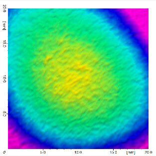 After 1 month Result Image