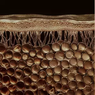 Skin tissues negatively impacted by larger adipocytes