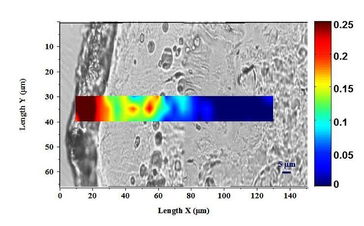 Pro-XylaneTM in Bandage Cream Technology Image