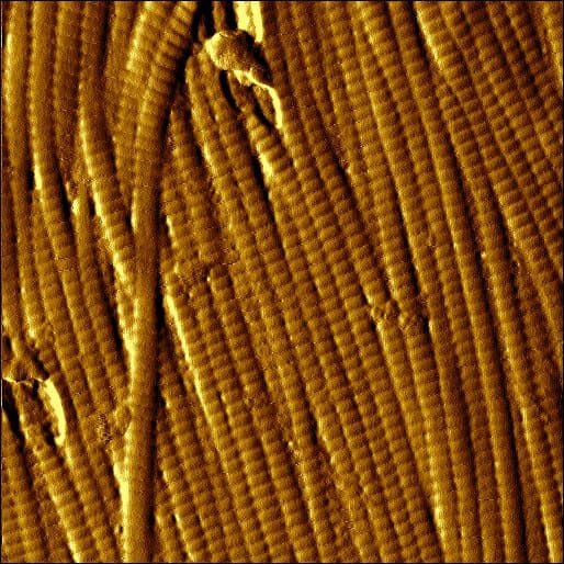 Scientific AFM analysis of glycated skin with structural disorganization of collagen fibers.