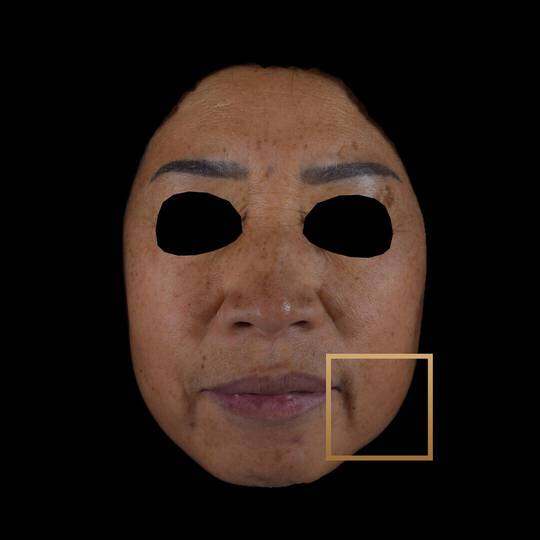 After 1 jar Result Image