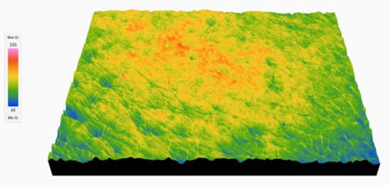 Scientific analysis of skin texture before applying Replasty day bandage care
